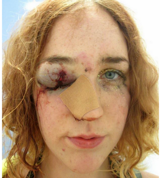 Illustration for article titled Woman Brutally Attacked for Telling a Man to Stop Groping Her